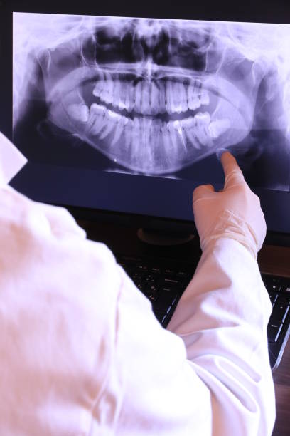 Best Emergency Denture Repair in Atlantic City, NJ